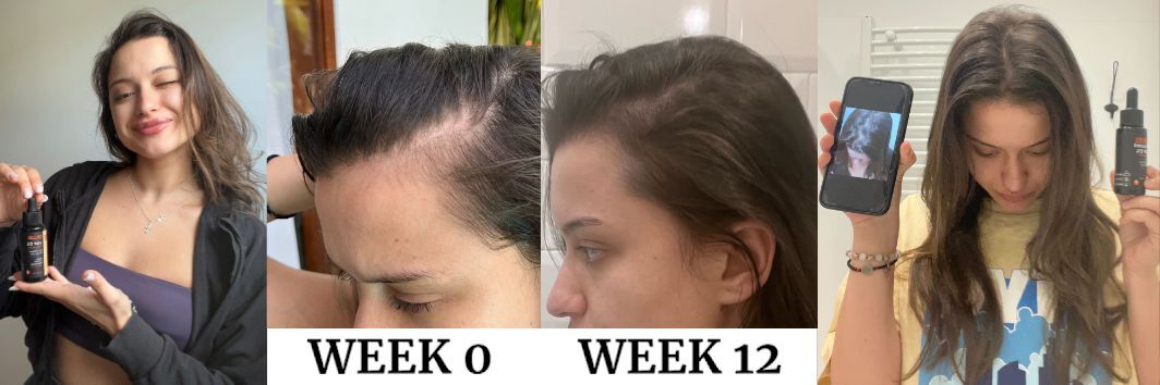 ADELINA full results