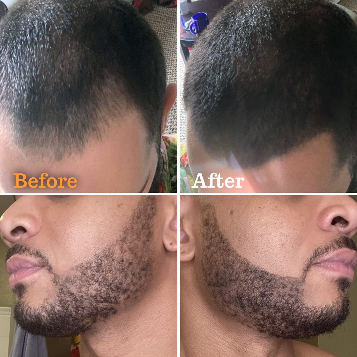 FOLLICLE BOOSTER Beard Pen Filler Styling Kit for Men - 3 - in - 1 Filling Set with 4 - Tip Fork, Normal Pencil, and Brush - Waterproof, Sweatproof & All - Day Hold - Follicle Booster