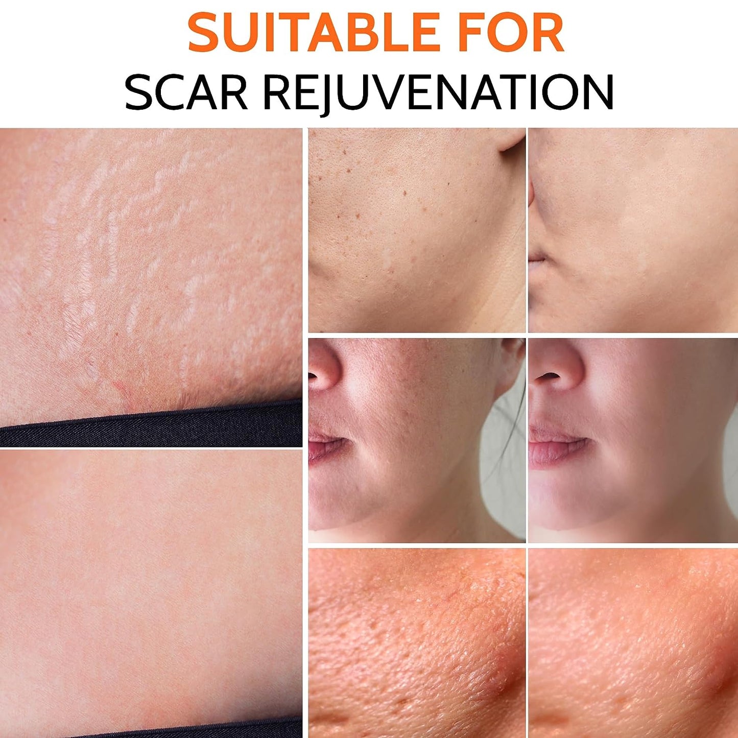 Adjustable Derma Stamp with Titanium Needles - Follicle Booster