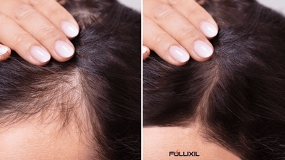 4 Essential Steps to Help Prevent Hair Loss - Follicle Booster