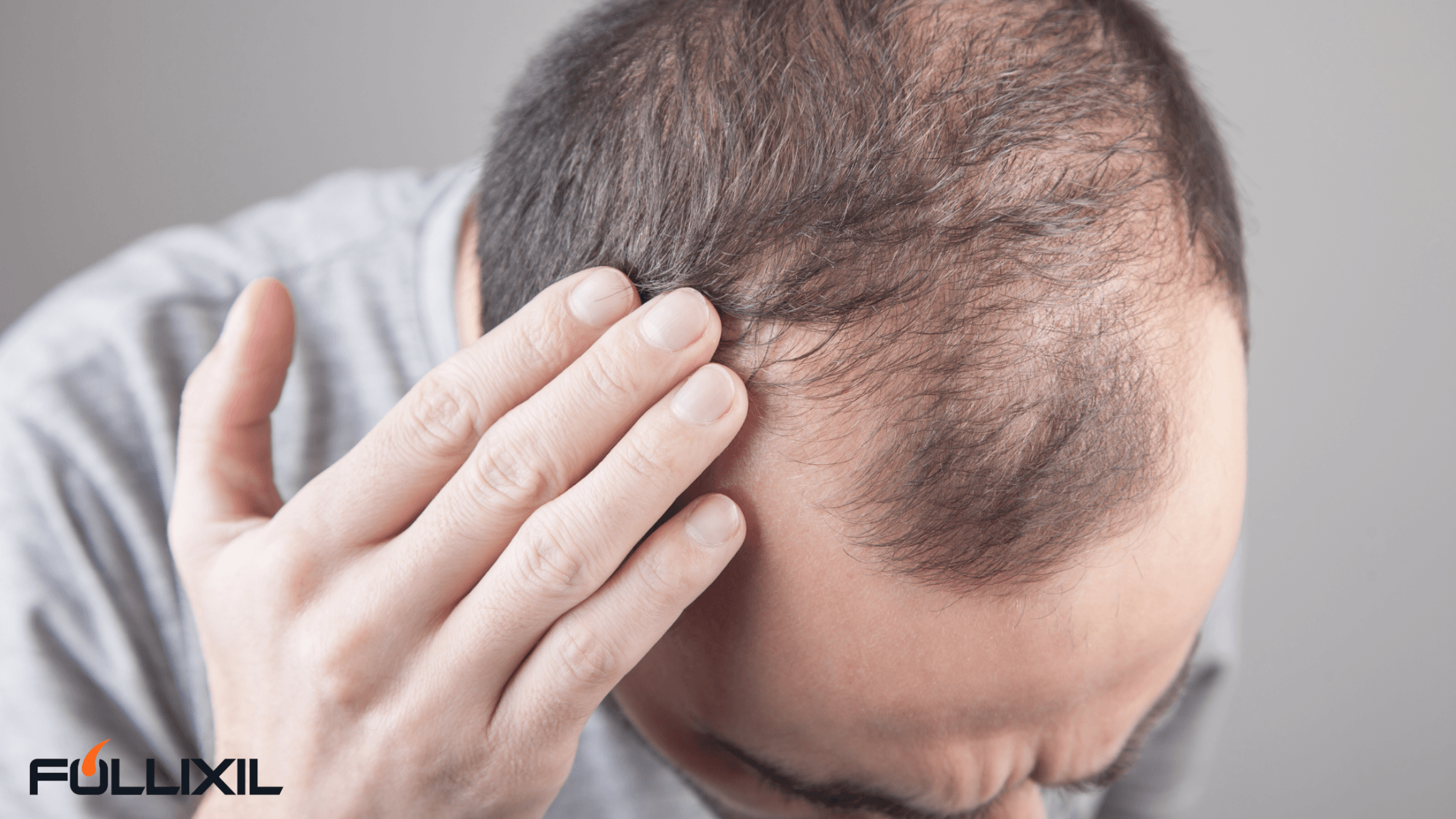 Hair Loss Remedies that Actually Work: Do This At Home - Follicle Booster