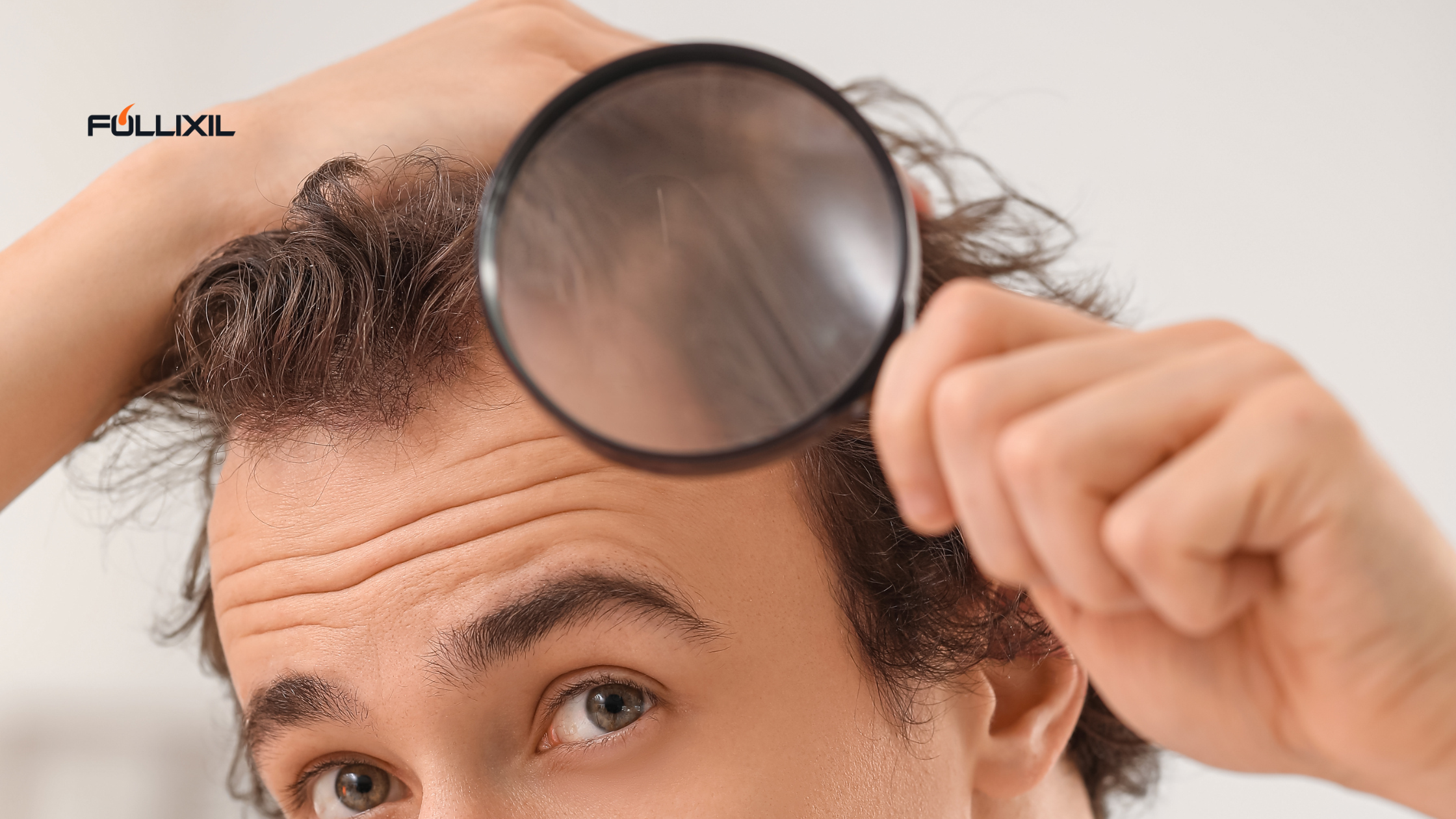 What Really Happens When You Stop Using Minoxidil
