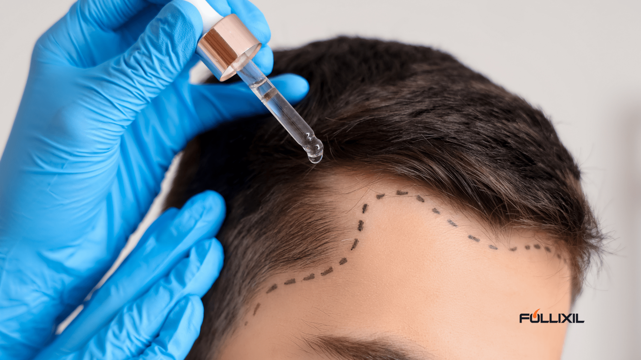 Seasonal Hair Shedding: Why Hair Falls More in Certain Months and How to Stop It - Follicle Booster