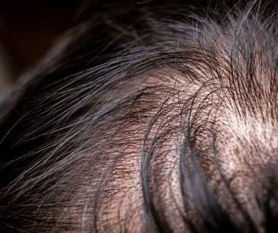 Sleep, Stress &amp; Screen Time: How Teen Habits Impact Hair Health - Follicle Booster