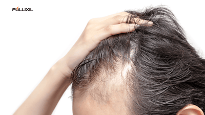The Early Hair Loss Reality for Men: What You Need to Know - Follicle Booster