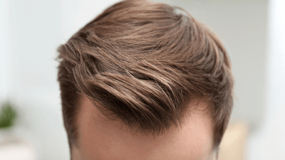 The Truth About Male Hair Loss in 2026 (And What Men Are Finally Doing About It) - Follicle Booster
