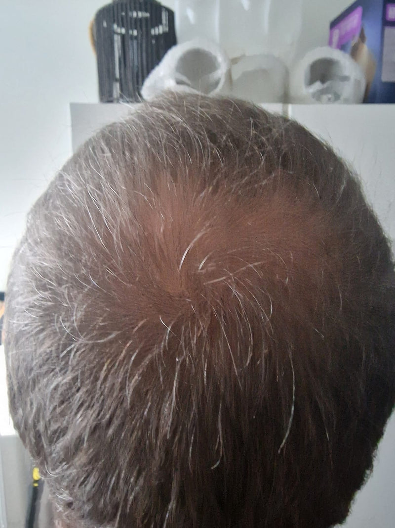 Before