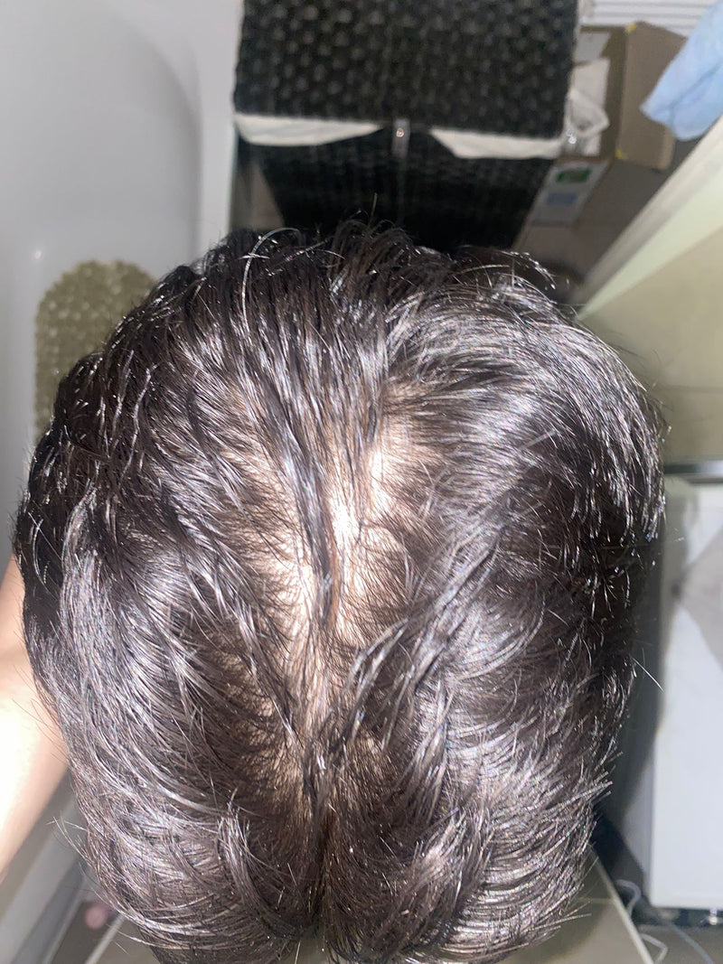 After